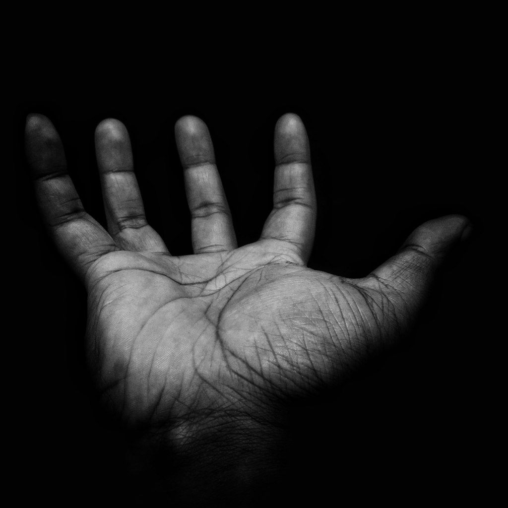 In the Qur'an, the staff also becomes a serpent, and the hand becomes white, but the context is diff